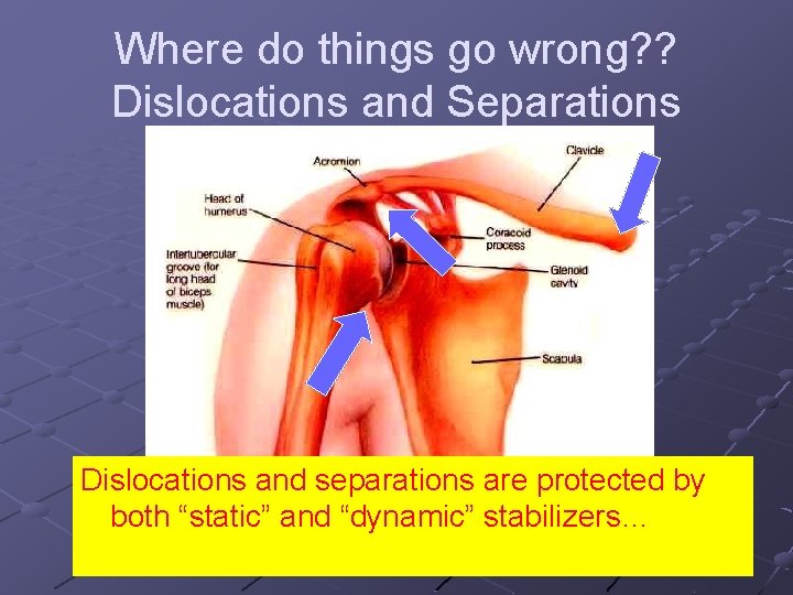 Where do things go wrong? ? Dislocations and Separations Dislocations and separations are protected