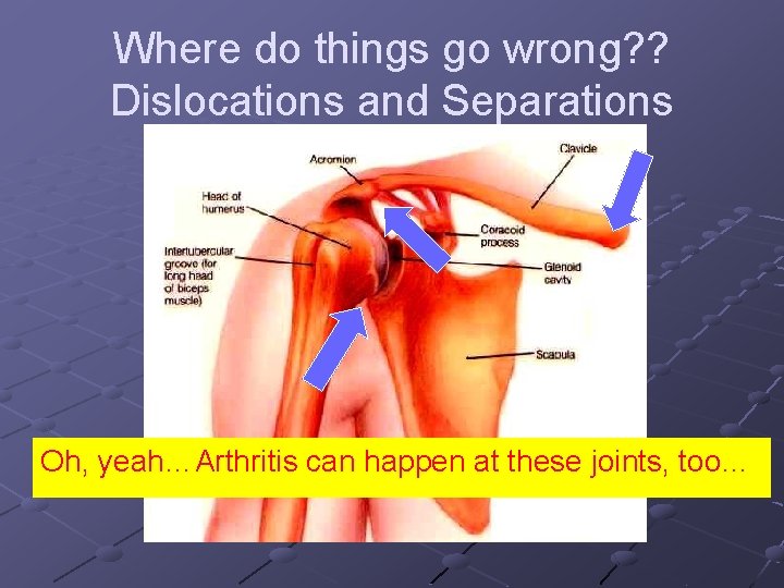 Where do things go wrong? ? Dislocations and Separations Oh, yeah…Arthritis can happen at