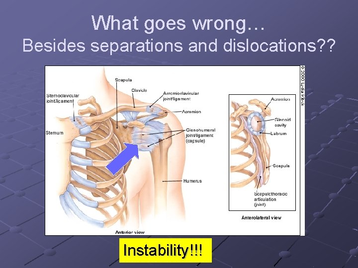 What goes wrong… Besides separations and dislocations? ? Instability!!! 