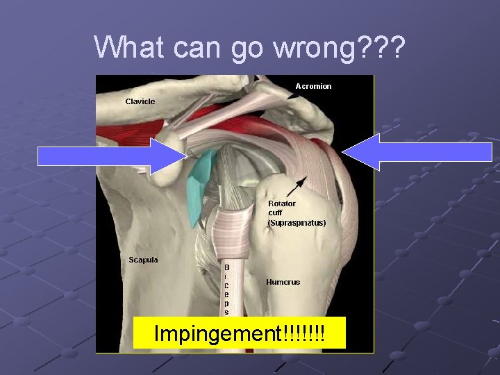 What can go wrong? ? ? Impingement!!!!!!! 