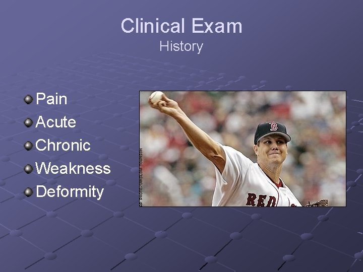 Clinical Exam History Pain Acute Chronic Weakness Deformity 