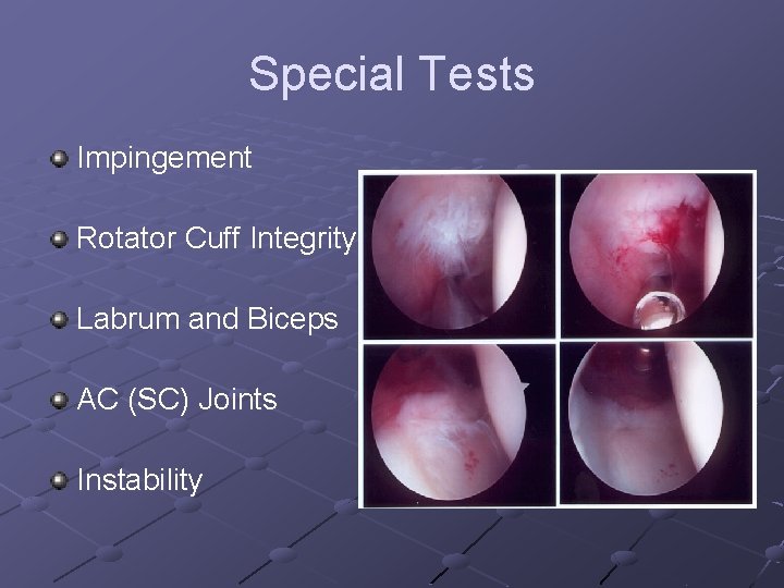 Special Tests Impingement Rotator Cuff Integrity Labrum and Biceps AC (SC) Joints Instability 