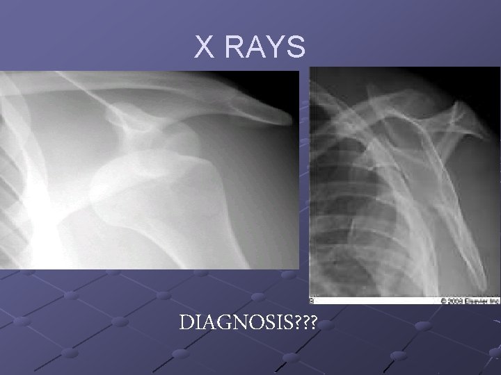 X RAYS DIAGNOSIS? ? ? 
