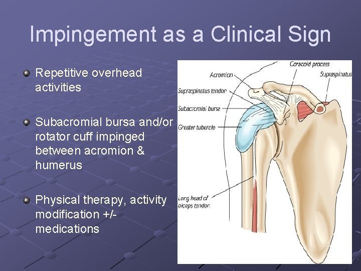 Impingement as a Clinical Sign Repetitive overhead activities Subacromial bursa and/or rotator cuff impinged