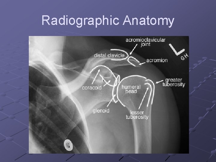 Radiographic Anatomy 