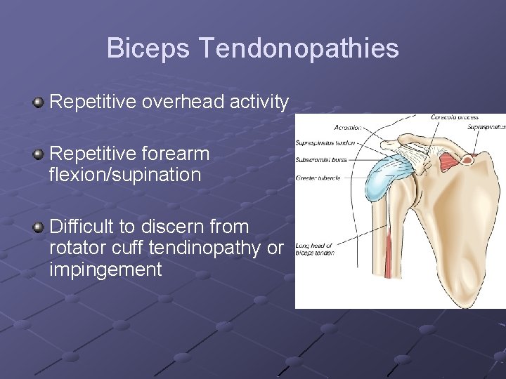 Biceps Tendonopathies Repetitive overhead activity Repetitive forearm flexion/supination Difficult to discern from rotator cuff