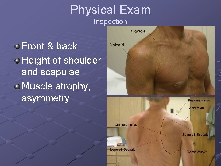 Physical Exam Inspection Front & back Height of shoulder and scapulae Muscle atrophy, asymmetry