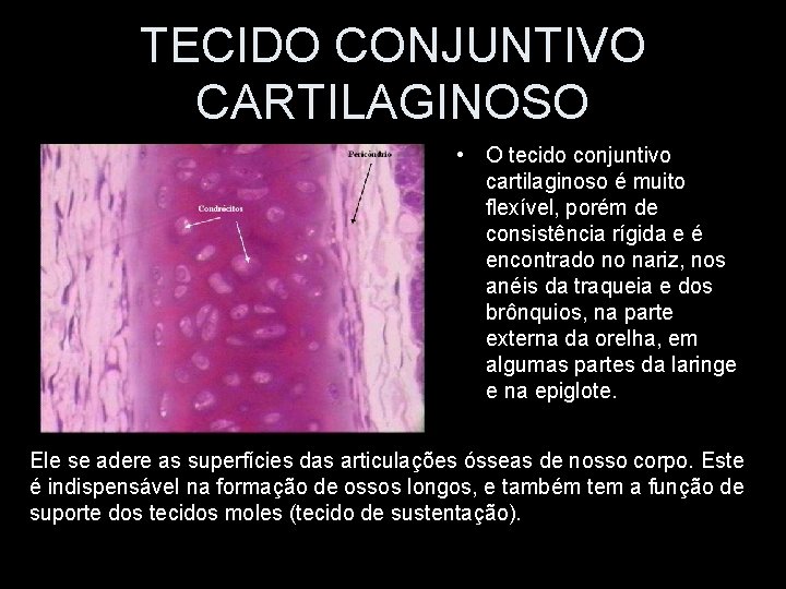 TECIDO CONJUNTIVO CARTILAGINOSO • O tecido conjuntivo cartilaginoso é muito flexível, porém de consistência