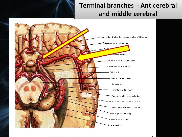 Terminal branches - Ant cerebral and middle cerebral 