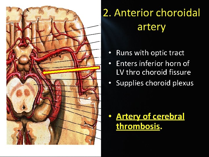 2. Anterior choroidal artery • Runs with optic tract • Enters inferior horn of