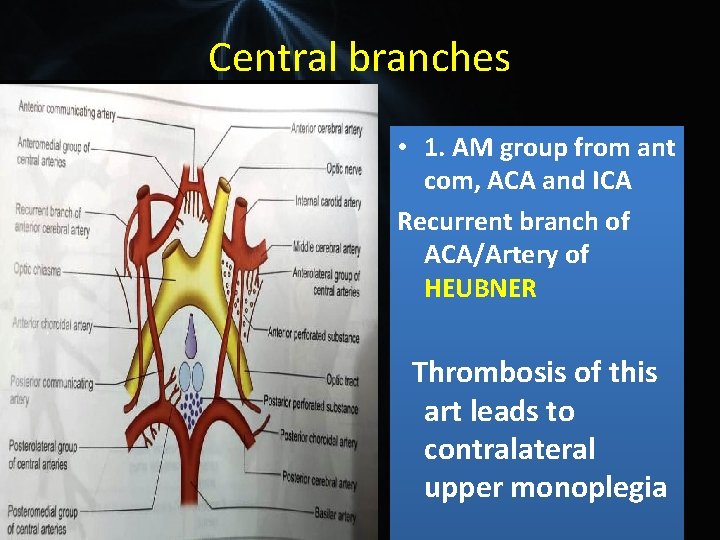 Central branches • 1. AM group from ant com, ACA and ICA Recurrent branch