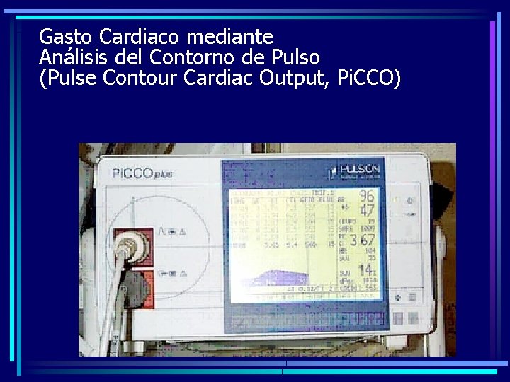 Gasto Cardiaco mediante Análisis del Contorno de Pulso (Pulse Contour Cardiac Output, Pi. CCO)