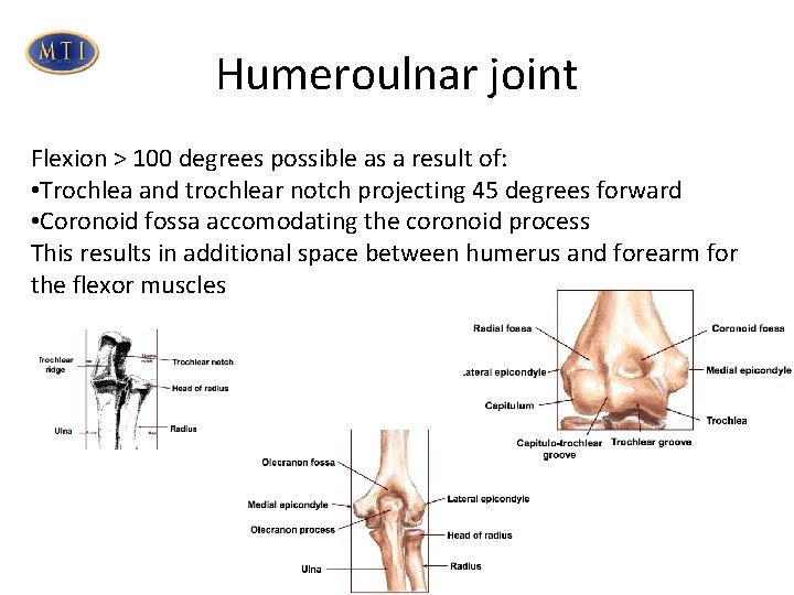 Humeroulnar joint Flexion > 100 degrees possible as a result of: • Trochlea and