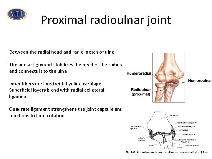 Proximal radioulnar joint Between the radial head and radial notch of ulna The anular Proximal radioulnar joint Between the radial head and radial notch of ulna The anular