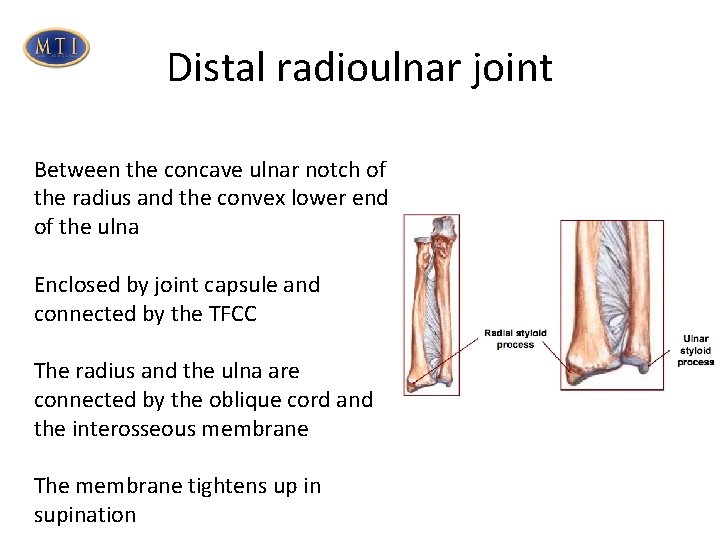 Distal radioulnar joint Between the concave ulnar notch of the radius and the convex Distal radioulnar joint Between the concave ulnar notch of the radius and the convex