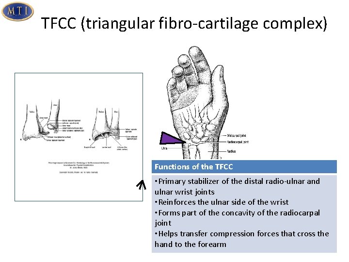 TFCC (triangular fibro-cartilage complex) Functions of the TFCC • Primary stabilizer of the distal