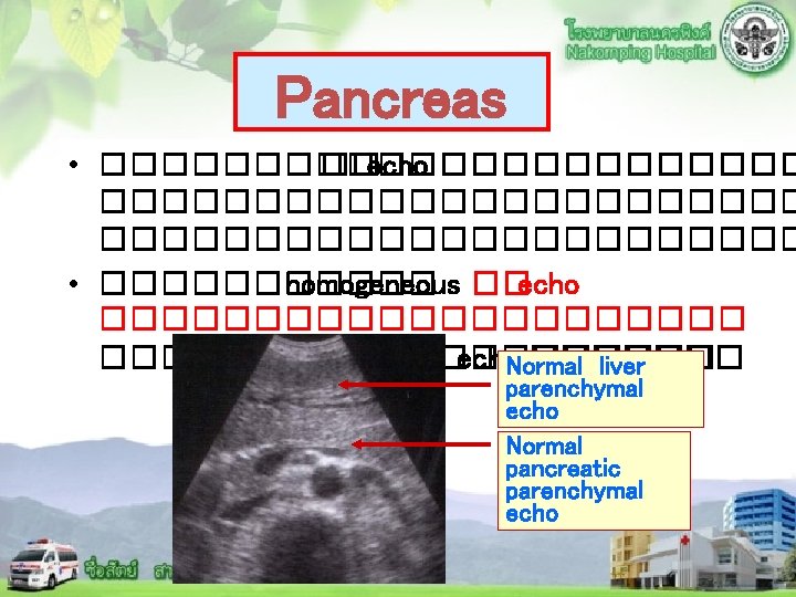 Pancreas • ������ ��echo ������������������ • ������ homogeneous ��echo ����������� echo. Normal ������� liver