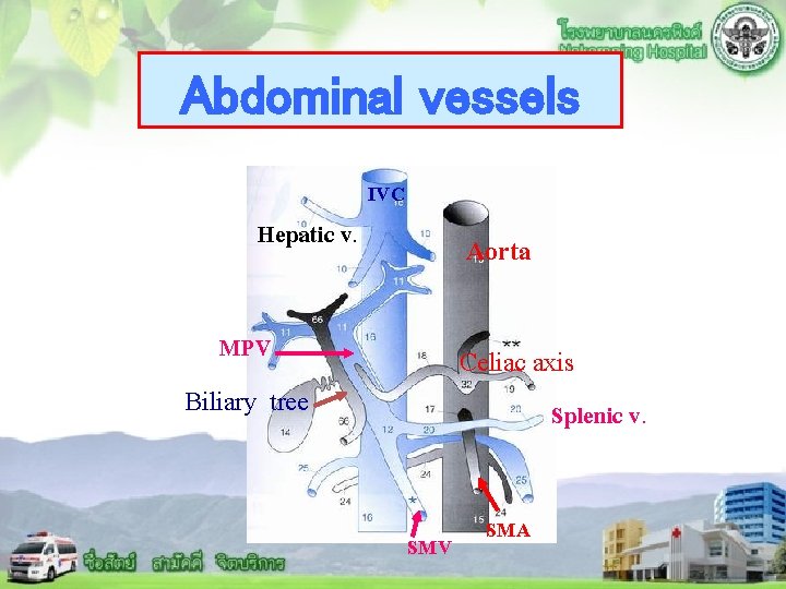 Abdominal vessels Hepatic v. IVC Aorta MPV Celiac axis Biliary tree Splenic v. SMV