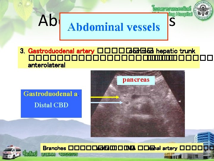 Abdominal vessels 3. Gastroduodenal artery ���� common hepatic trunk �������������� anterolateral Gastroduodenal a. Distal