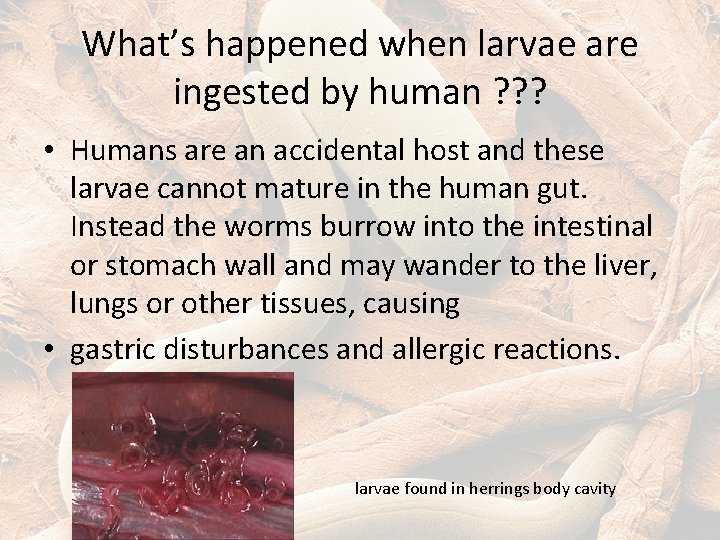 What’s happened when larvae are ingested by human ? ? ? • Humans are