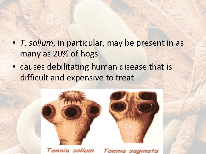  • T. solium, in particular, may be present in as many as 20%