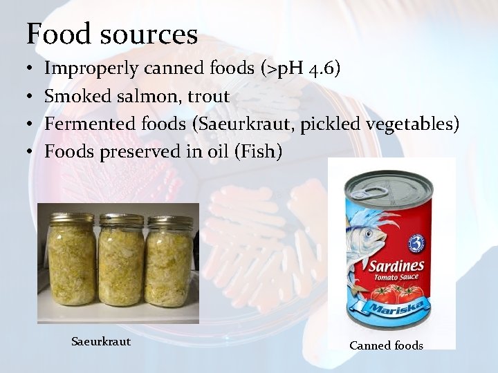 Food sources • • Improperly canned foods (>p. H 4. 6) Smoked salmon, trout