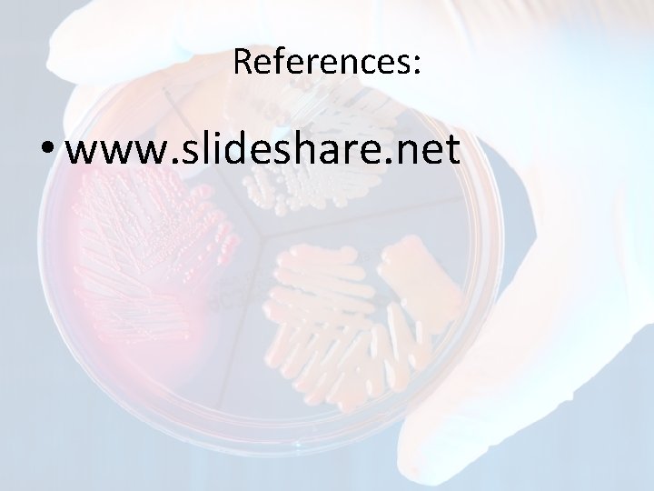 References: • www. slideshare. net 