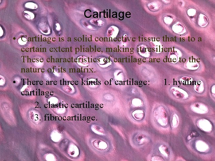 Cartilage • Cartilage is a solid connective tissue that is to a certain extent