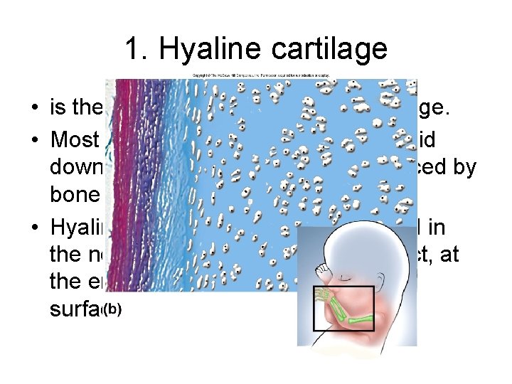 1. Hyaline cartilage • is the most abundant type of cartilage. • Most of