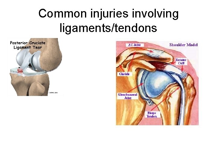 Common injuries involving ligaments/tendons 