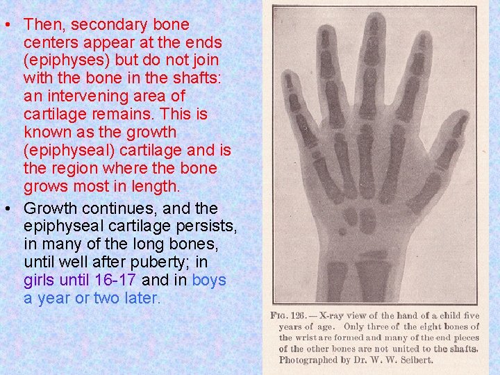  • Then, secondary bone centers appear at the ends (epiphyses) but do not