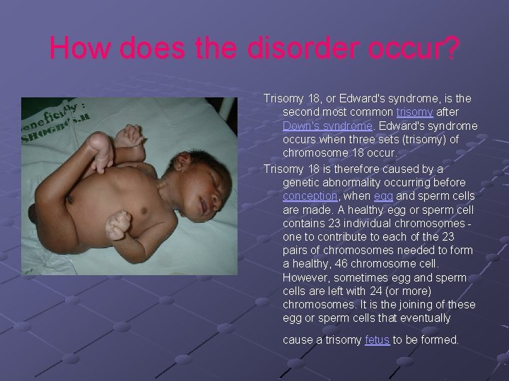How does the disorder occur? Trisomy 18, or Edward's syndrome, is the second most
