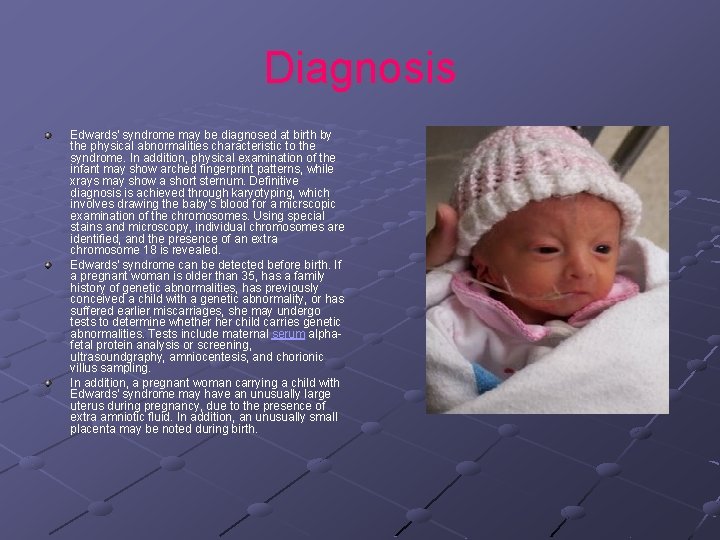 Diagnosis Edwards' syndrome may be diagnosed at birth by the physical abnormalities characteristic to