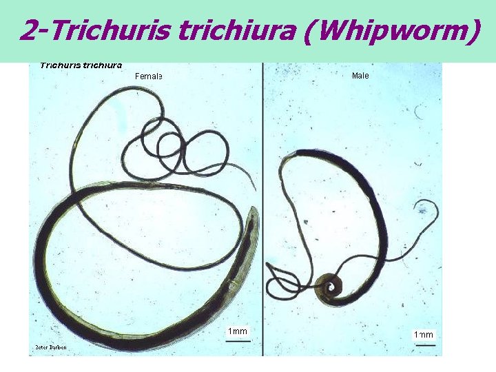 2 -Trichuris trichiura (Whipworm) 