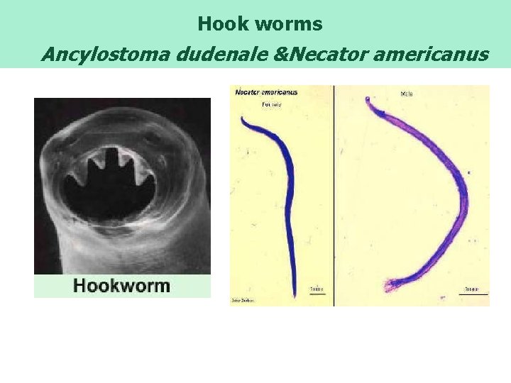  Hook worms Ancylostoma dudenale &Necator americanus 