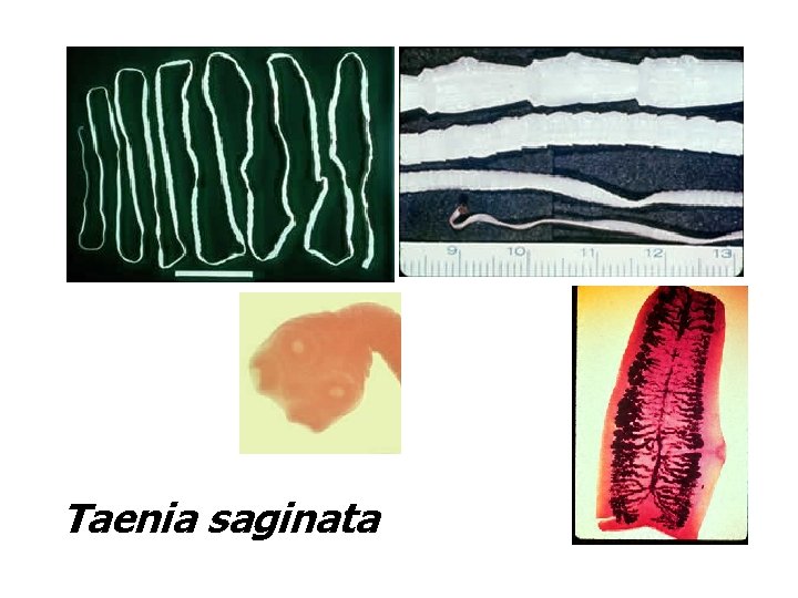 Taenia saginata 