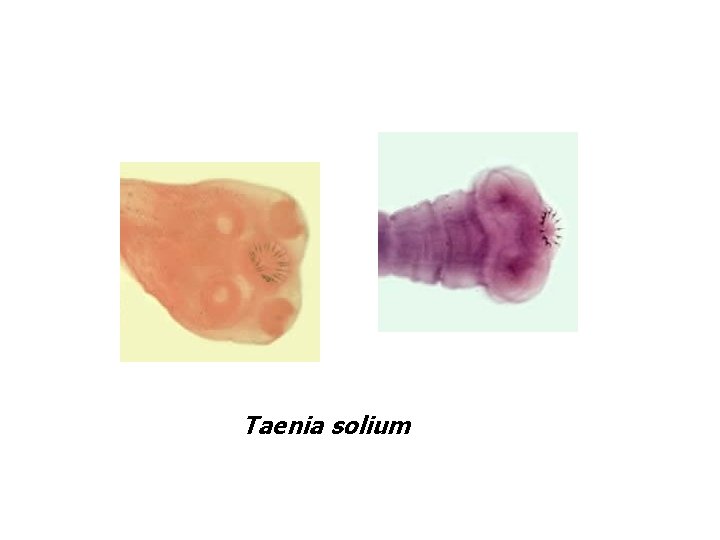 Taenia solium 