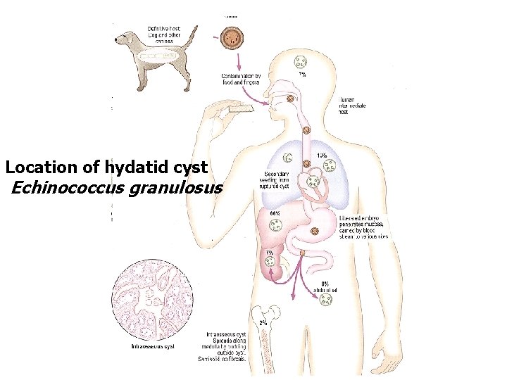 Location of hydatid cyst Echinococcus granulosus 