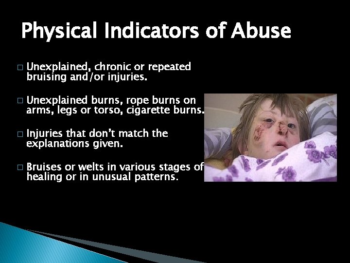Physical Indicators of Abuse � � Unexplained, chronic or repeated bruising and/or injuries. Unexplained