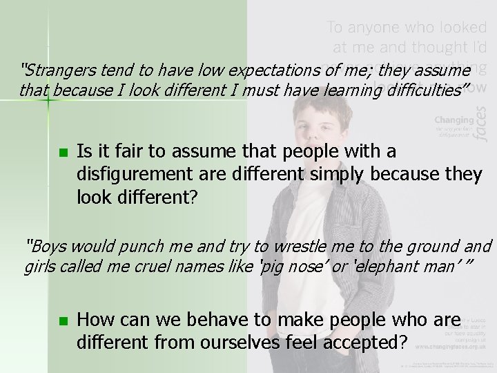 “Strangers tend to have low expectations of me; they assume that because I look