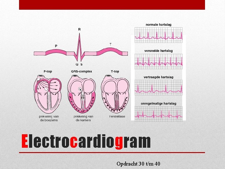 Electrocardiogram Opdracht 30 t/m 40 