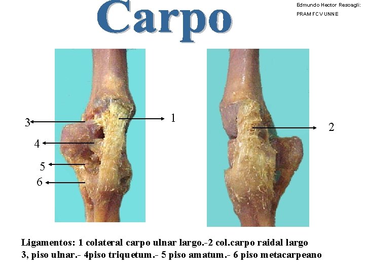 Edmundo Hector Resoagli: PRAM FCV UNNE 1 3 4 5 6 Ligamentos: 1 colateral