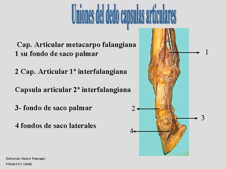 Cap. Articular metacarpo falangiana 1 su fondo de saco palmar 1 2 Cap. Articular