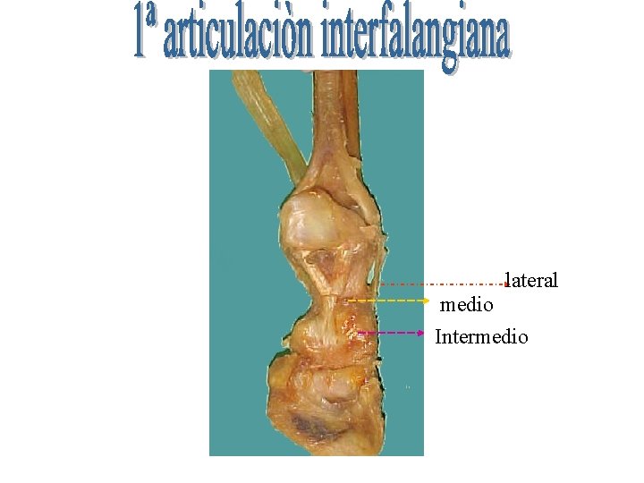 lateral medio Intermedio 