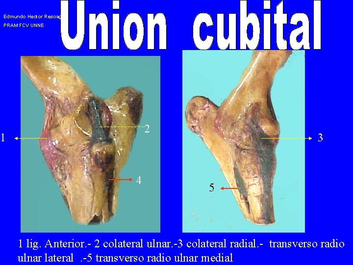 Edmundo Hector Resoagli: PRAM FCV UNNE 2 1 4 3 5 1 lig. Anterior.