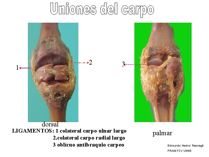 2 1 3 dorsal LIGAMENTOS: 1 colateral carpo ulnar largo 2. colateral carpo radial