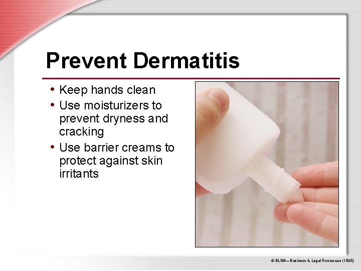Prevent Dermatitis • Keep hands clean • Use moisturizers to prevent dryness and cracking