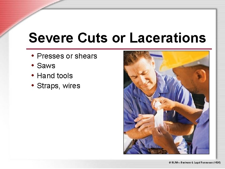 Severe Cuts or Lacerations • Presses or shears • Saws • Hand tools •