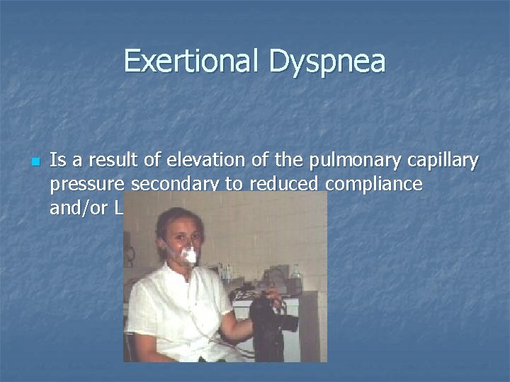 Exertional Dyspnea n Is a result of elevation of the pulmonary capillary pressure secondary