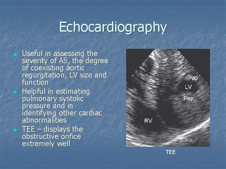 Echocardiography n n n Useful in assessing the severity of AS, the degree of